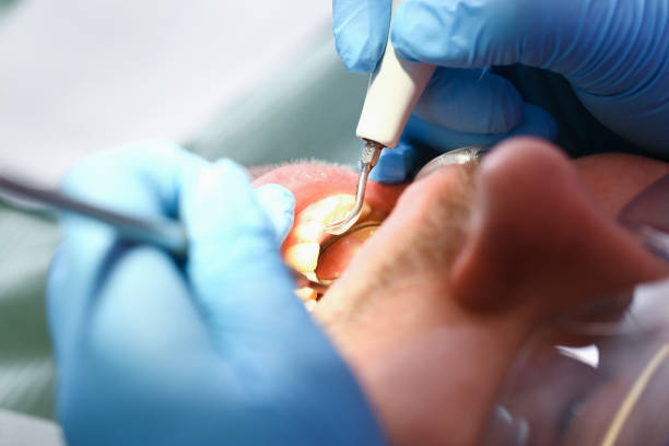Best Broken or Chipped Tooth Repair in Eaton Estates, OH