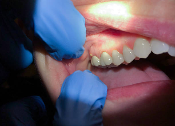 Best Emergency Treatment for Jaw Pain or Injury in Eaton Estates, OH