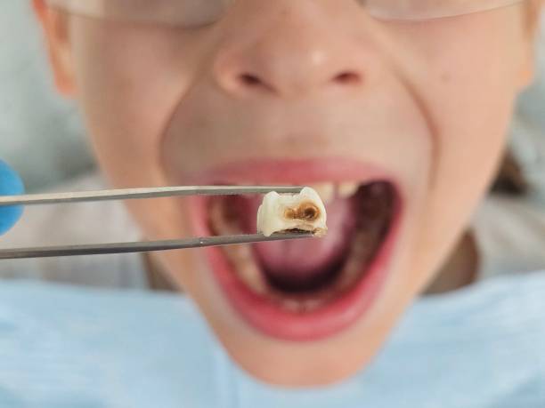 Best Emergency Treatment for Oral Infections in Eaton Estates, OH
